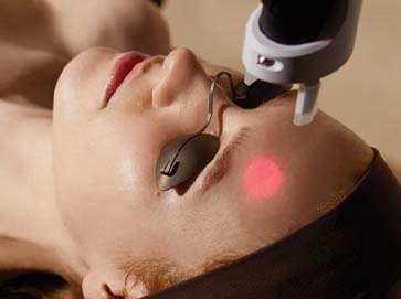 LASER RESURFACING